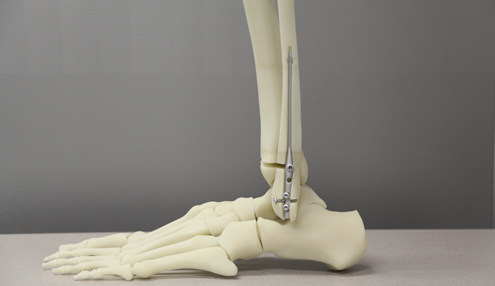 3D Printed Bone Models