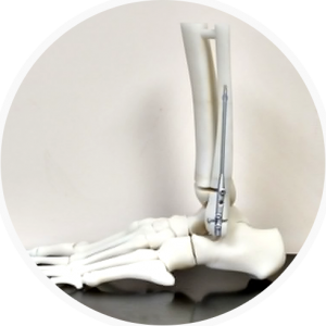 3d-printed-bone-model